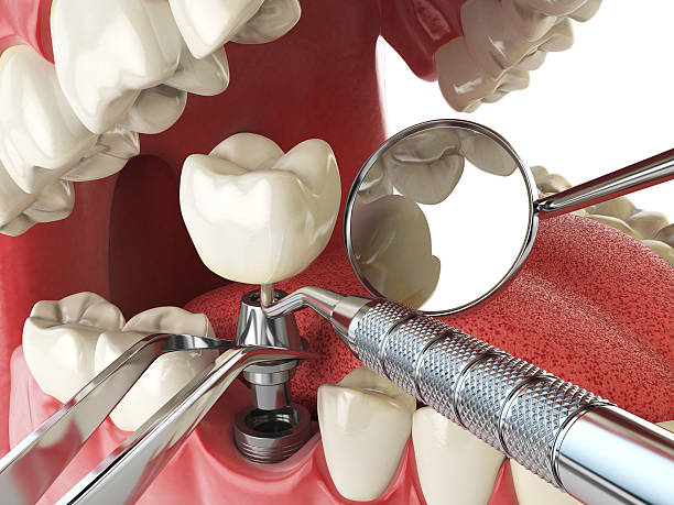 Best Weekend Emergency Dentist in Elkhart, TX